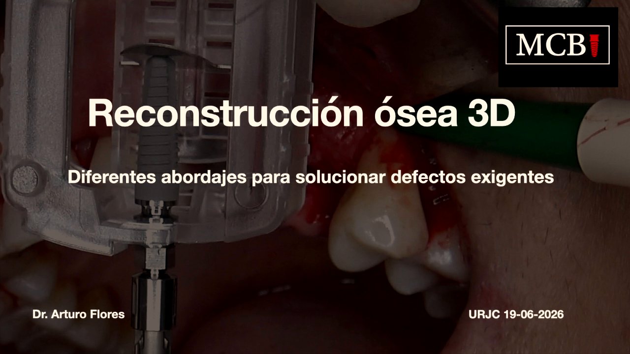 Arturo Flores (URJC) -  Reconstrucción ósea 3D. Diferentes abordajes para solucionar defectos exigentes
