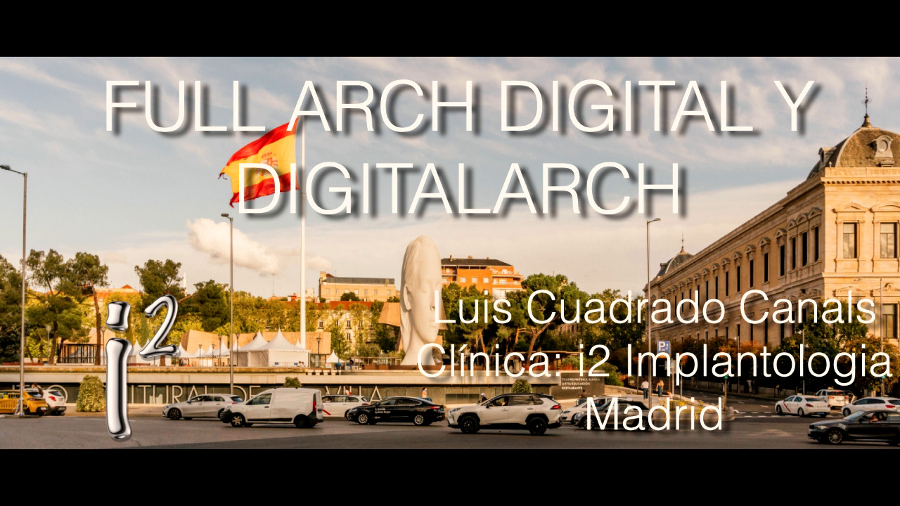 Luis cuadrado (BIONER) - Full Arch Digital. Cuando lo difícil deja de serlo. Nuevas tecnologías